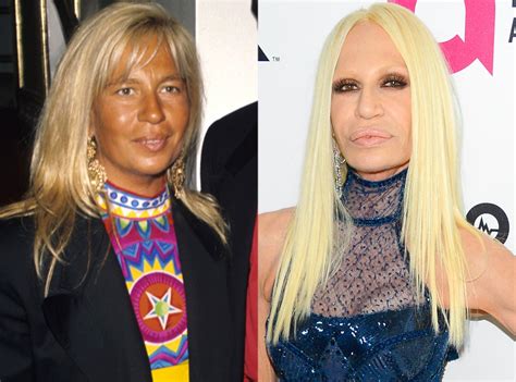 prima donatella versace|donatella versace before and after.